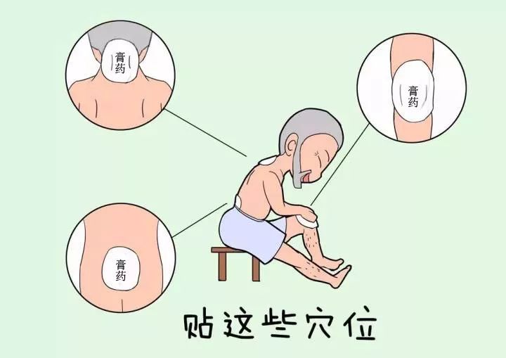南獅王膏藥是怎么治療骨病的?